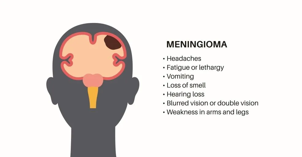 Depo-Provera Brain Tumor